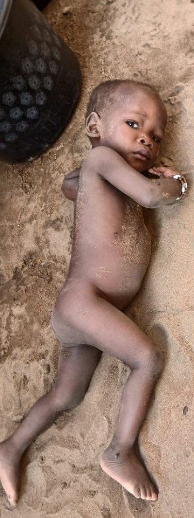 A young orphan (BEFORE SUPPORT)